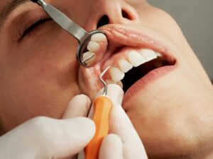 Dental Emergencies Warning: When to Call for Same-Day Care
