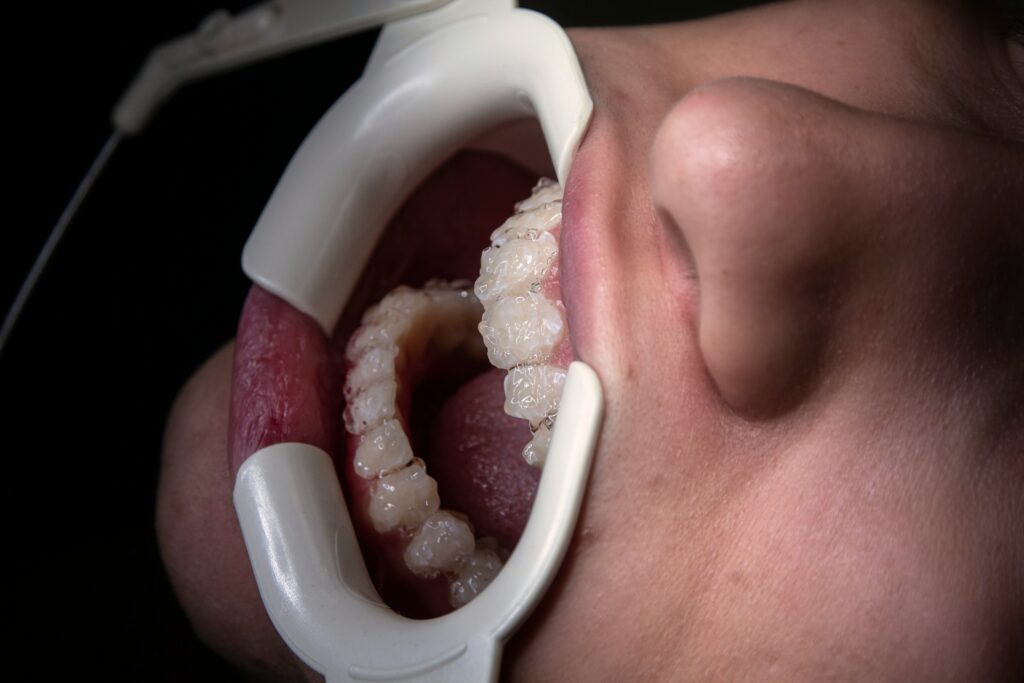 Dentists in Valdosta Who Truly Care About Your Smile